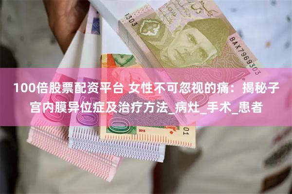 100倍股票配资平台 女性不可忽视的痛：揭秘子宫内膜异位症及治疗方法_病灶_手术_患者